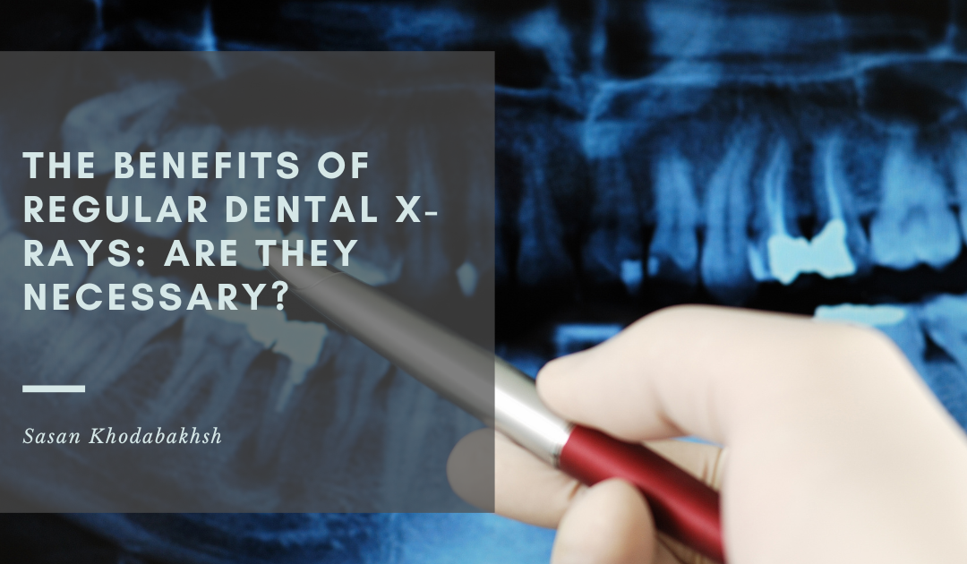 The Benefits of Regular Dental X-Rays: Are They Necessary?